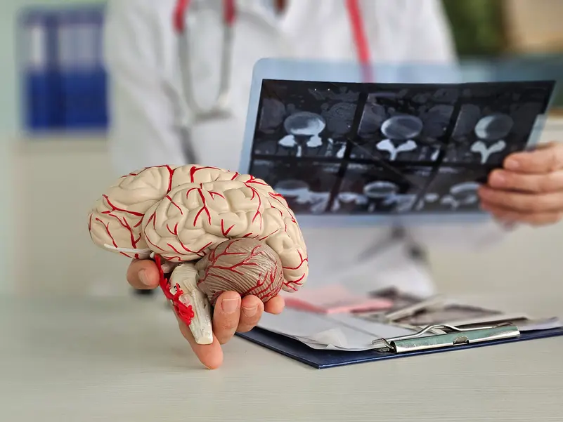 Alzheimer’s Protein